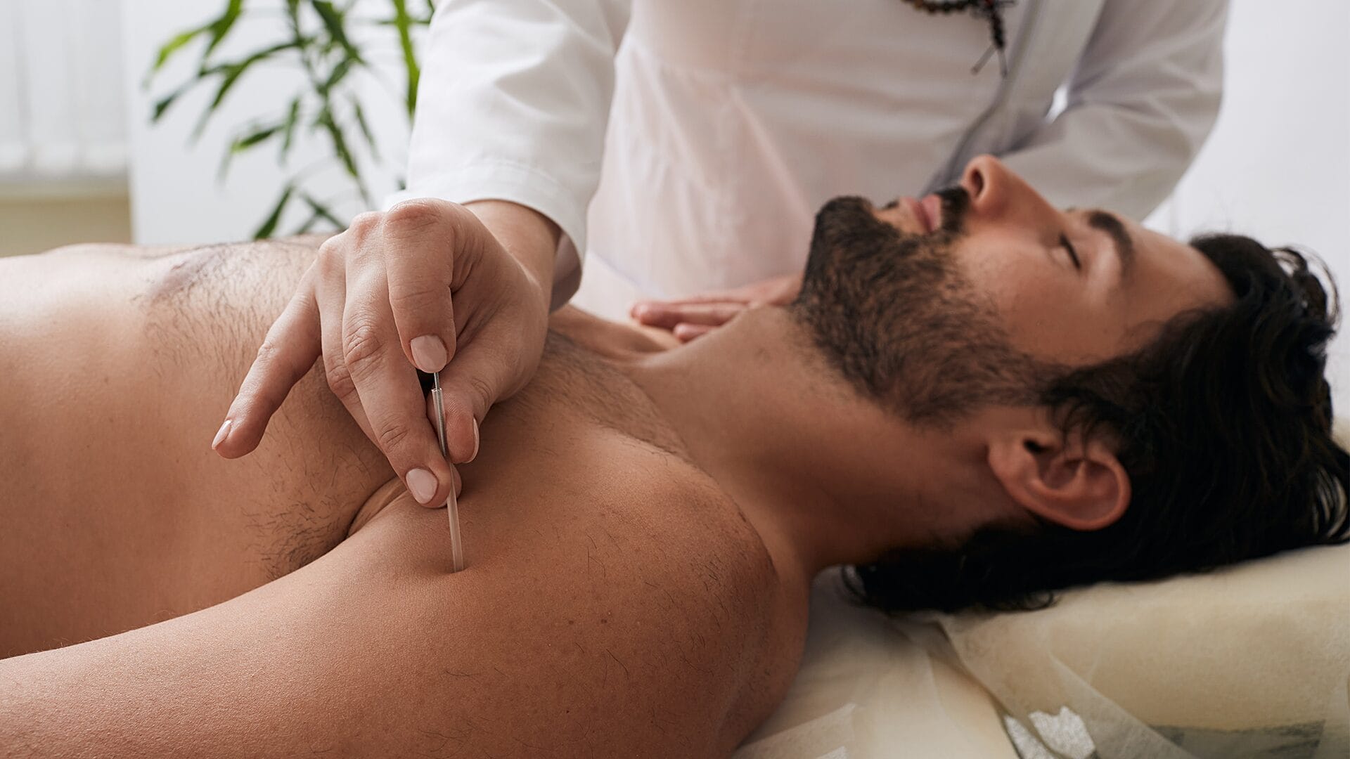 Male patient laying down during acupuncture and acutrigger therapy.