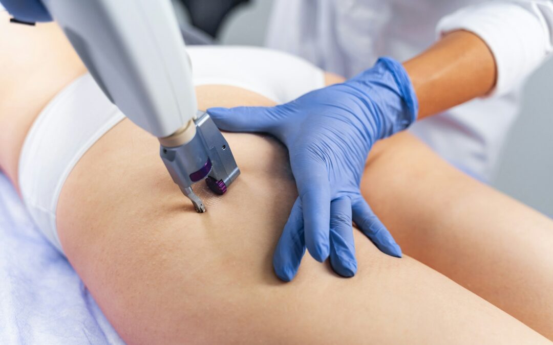 Why Emsculpt Neo Feels Different from Traditional Exercise in San Diego