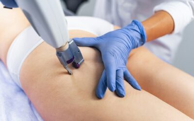Why Emsculpt Neo Feels Different from Traditional Exercise in San Diego